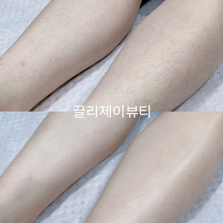 끌리제이뷰티 이미지