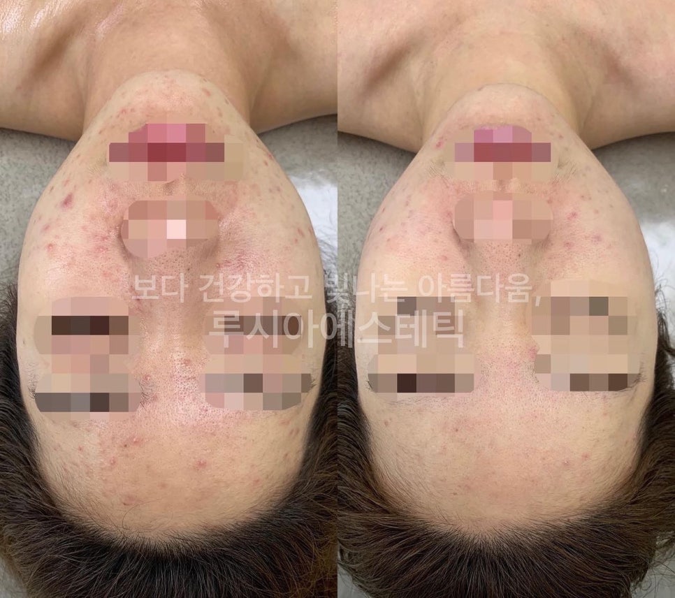 루시아스킨케어 이미지