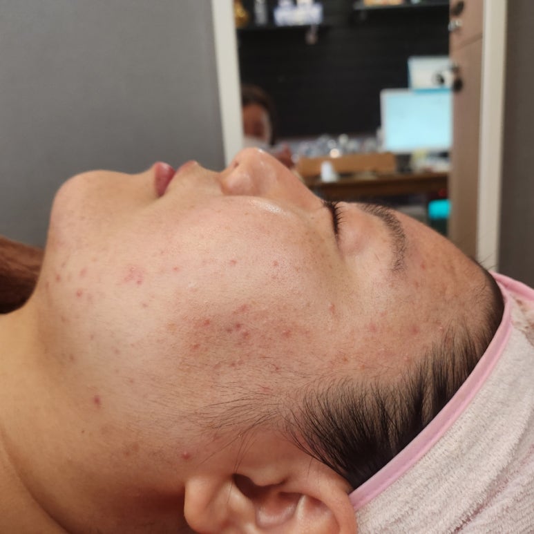 김채주스킨케어 이미지