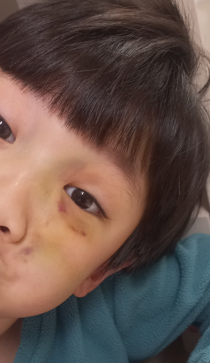 지압침대구성센타 이미지