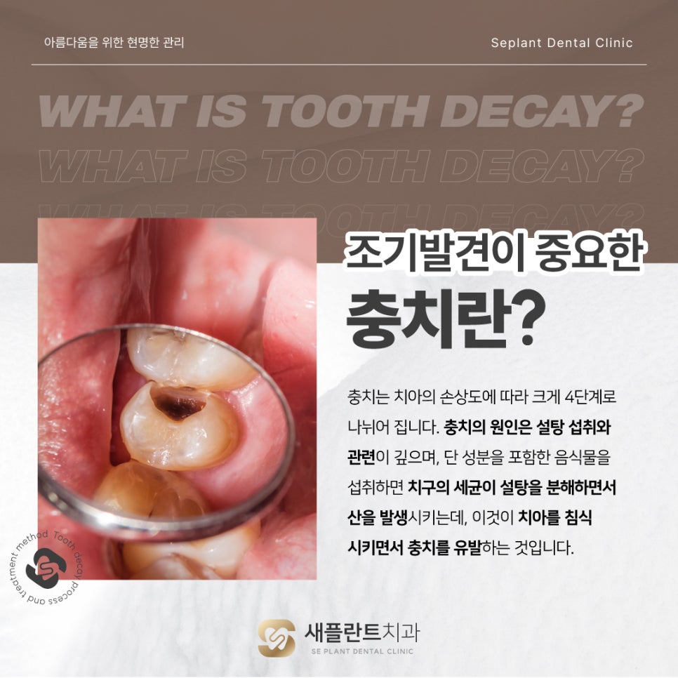 새서울플란트치과 이미지