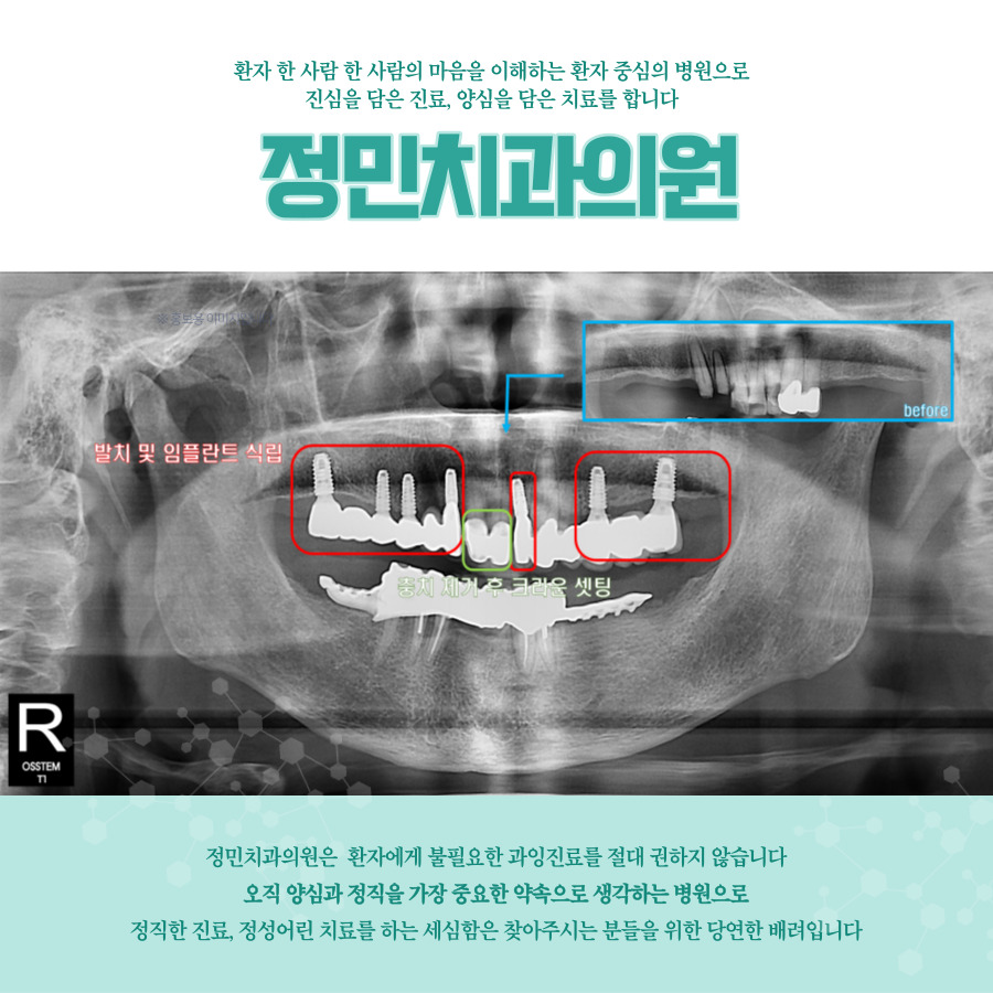 정민치과의원 이미지