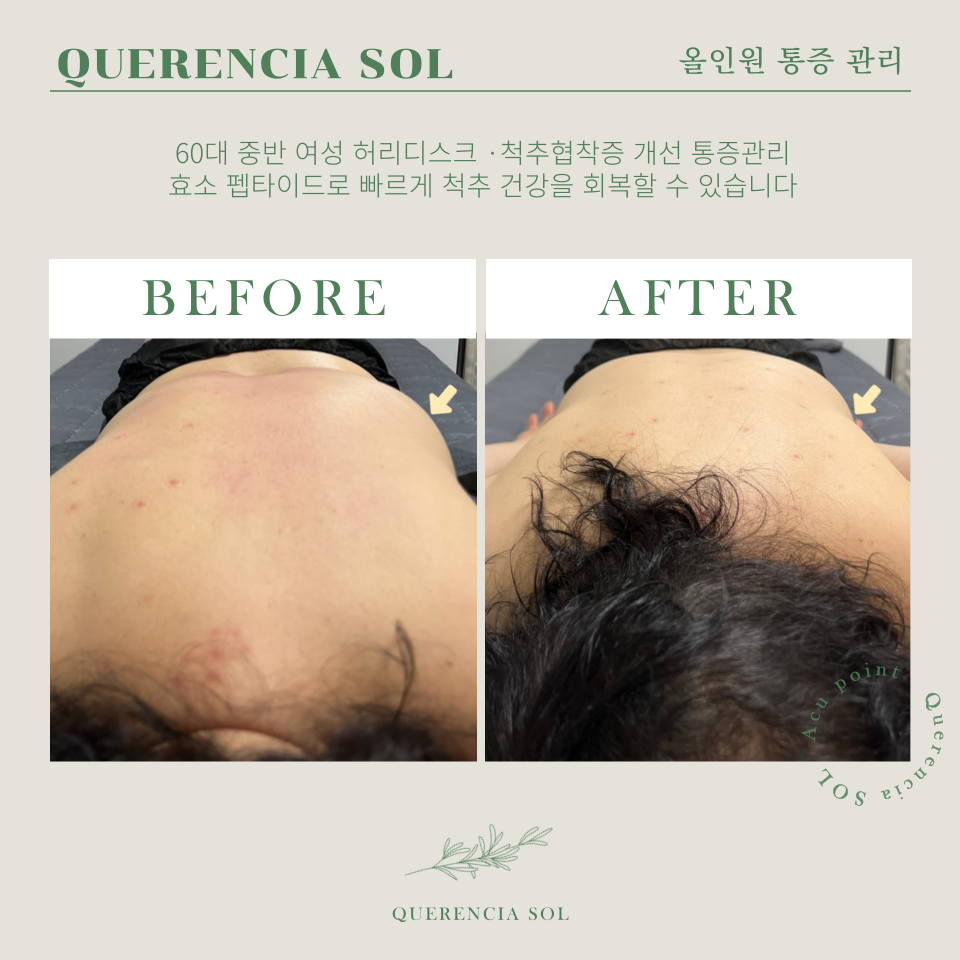 케렌시아 솔 이미지