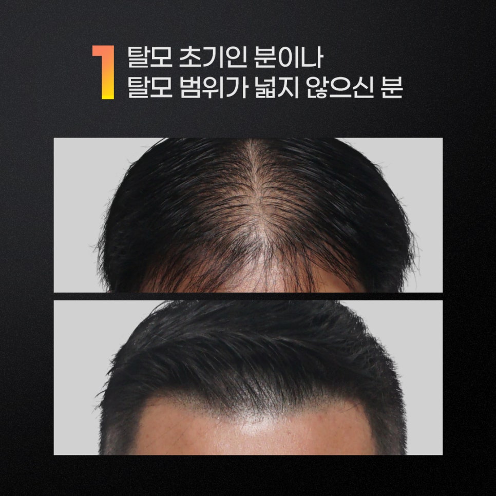 그레이인천 이미지