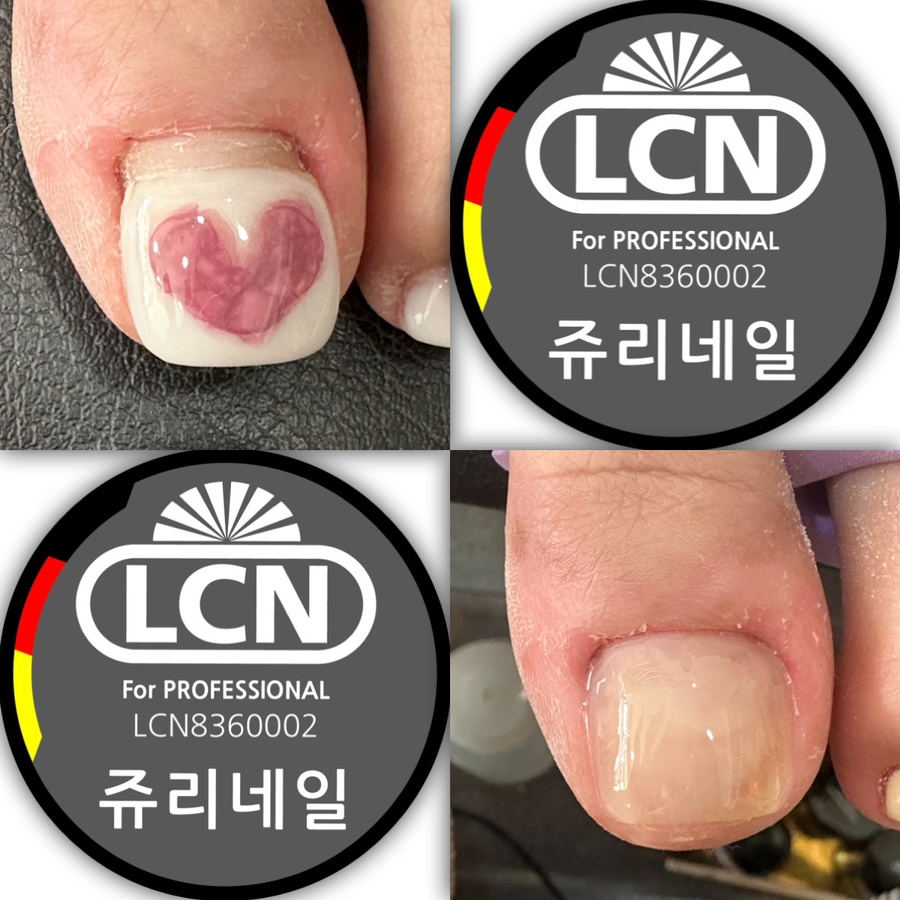 쥬리네일 이미지