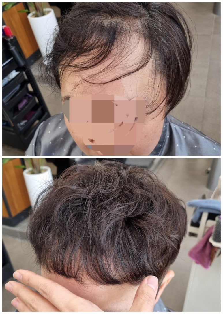 비에스헤어 이미지