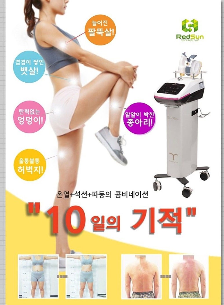 골드체형관리 이미지