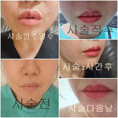 윤브로 이미지