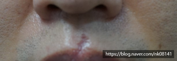 청담엔케이피부과청담NK피부과 이미지