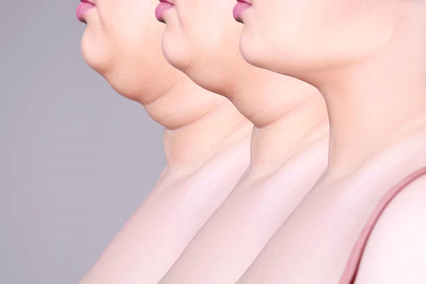 고은의원 이미지