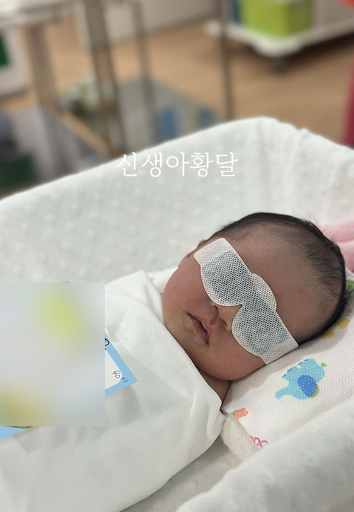 신생아 황달 수치 10 , 정상범위 기준 : 광선치료 후기 : 네이버 블로그