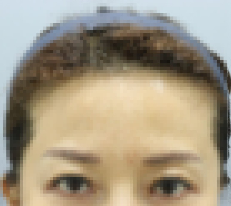 모자이크성형외과의원 이미지