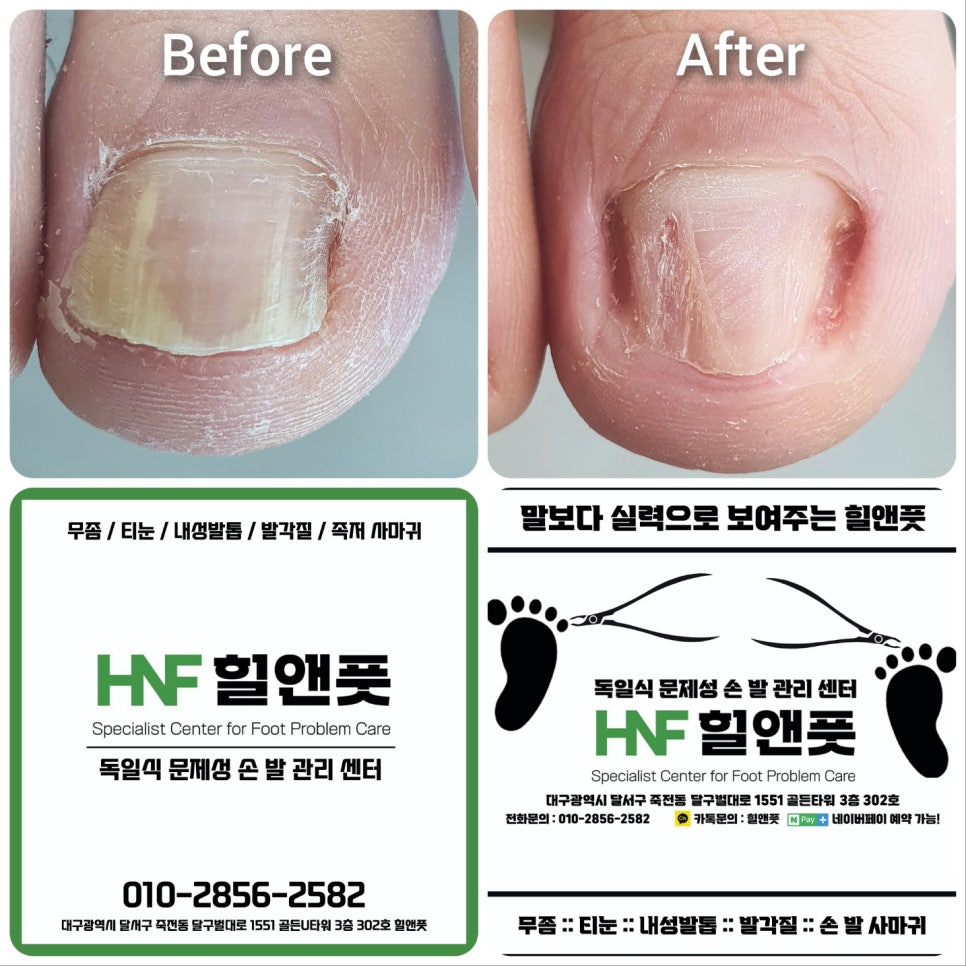 힐앤풋 이미지