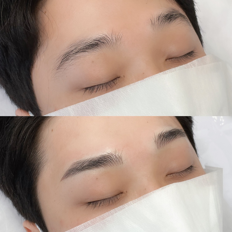 비프리티 이미지