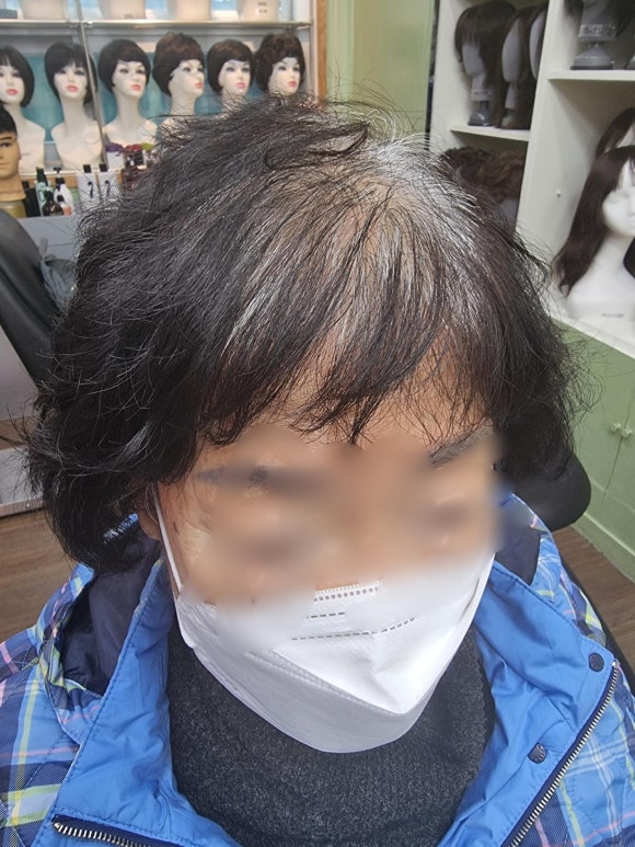 영등포가발 두해 이미지
