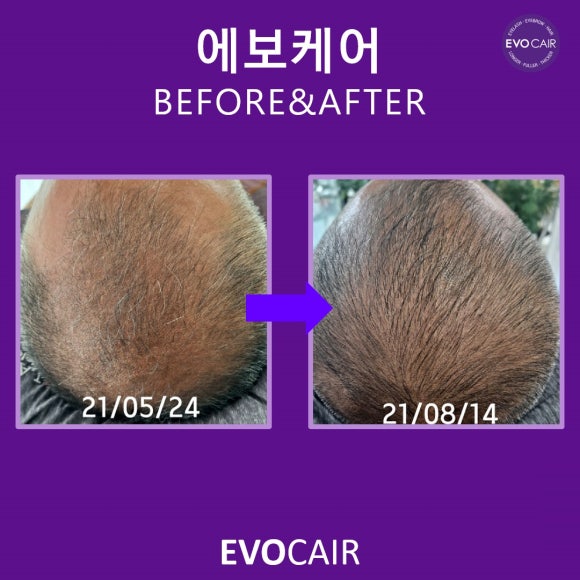 제제헤어 이미지