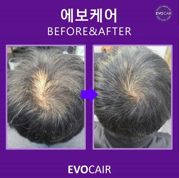 제제헤어 이미지