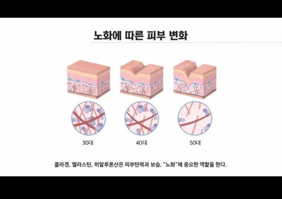 비아블 이미지