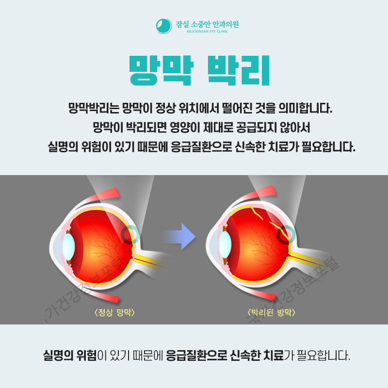 잠실소중안안과의원 이미지