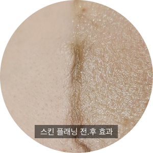 미엘피부관리 이미지