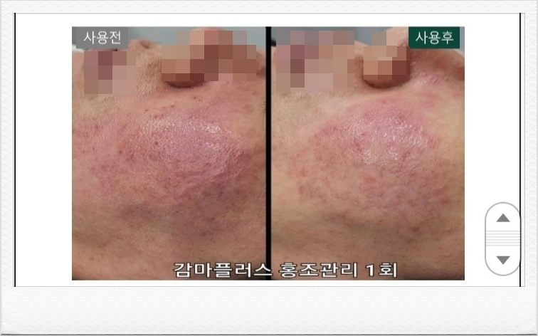 해라뷰티 이미지