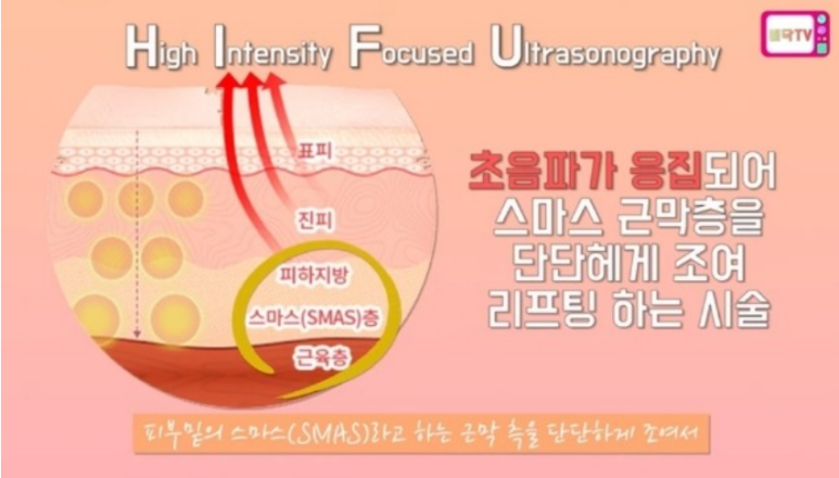 헤라피부관리실 이미지