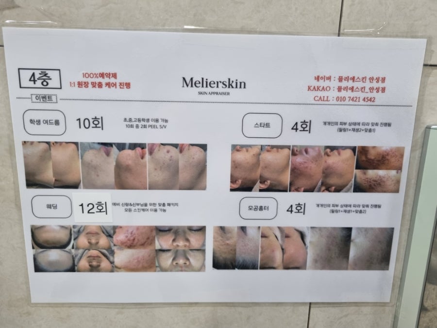 믈리에스킨 이미지