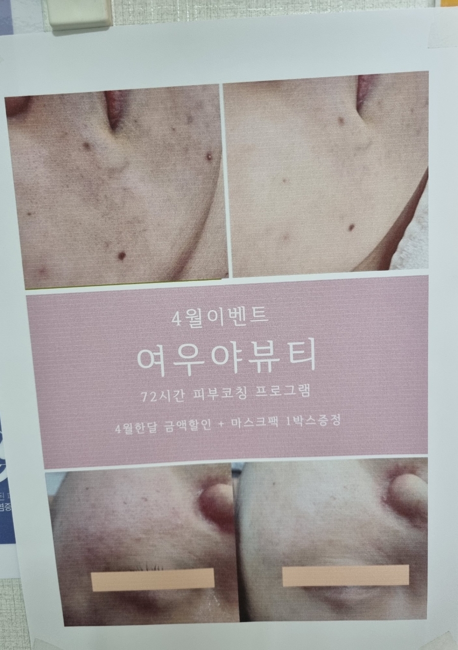 여우야뷰티 이미지
