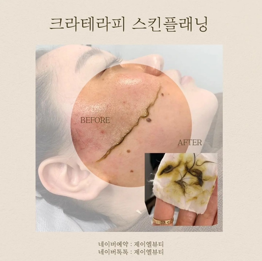 제이엘뷰티 이미지
