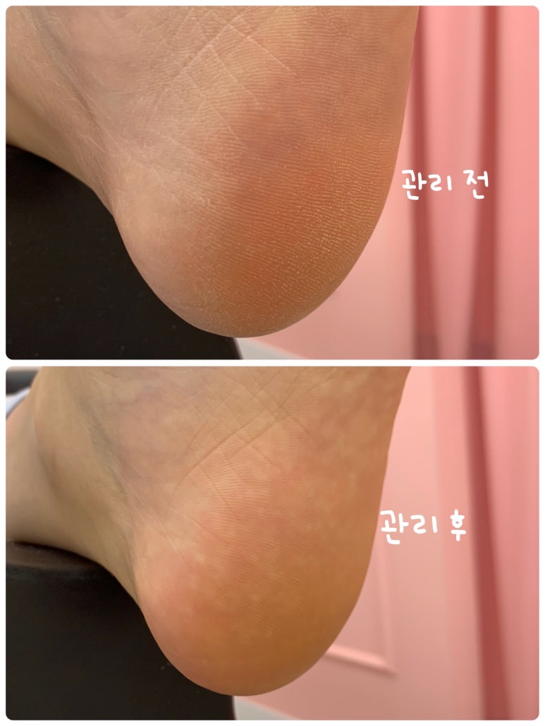 네일아드망 이미지