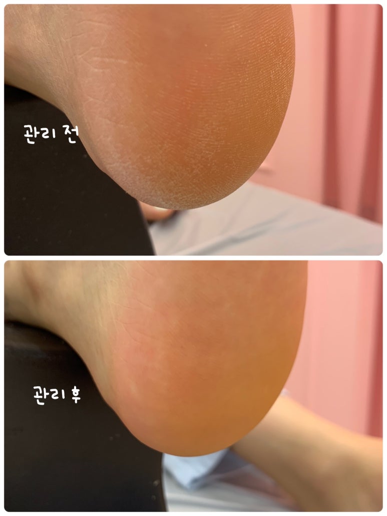 네일아드망 이미지