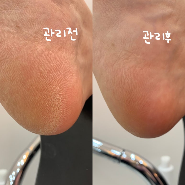 네일아드망 이미지