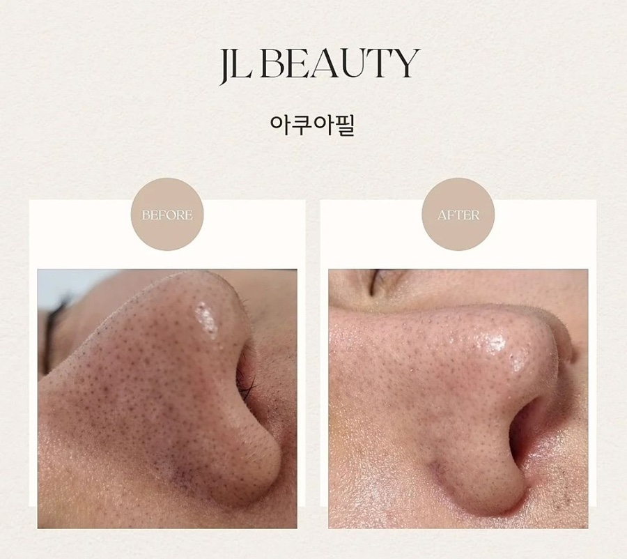 제이엘뷰티 이미지