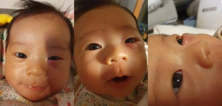 연세하늘안과의원 이미지