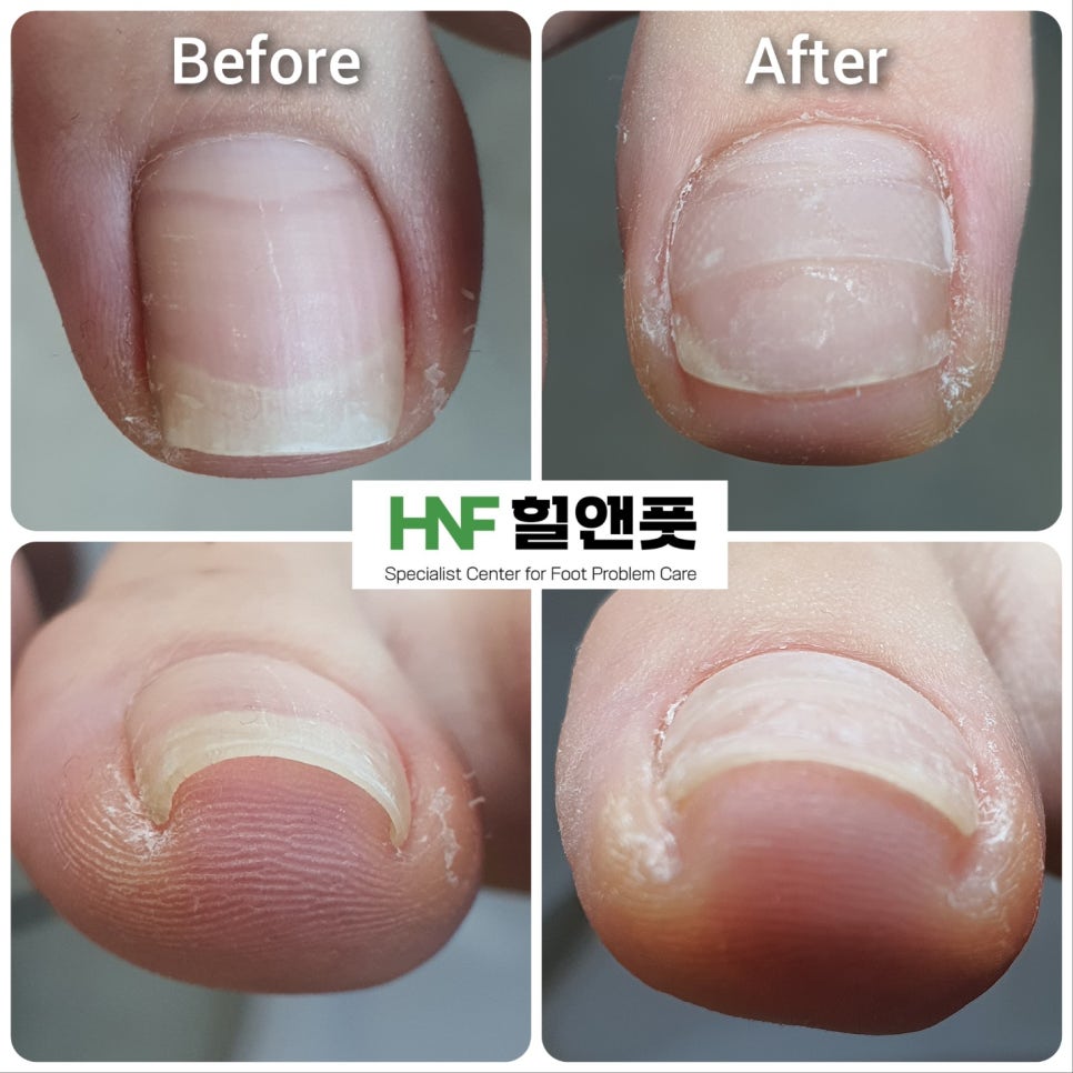 힐앤풋 이미지
