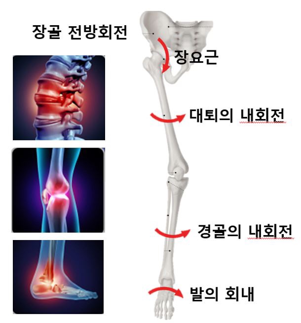 바른피티 이미지