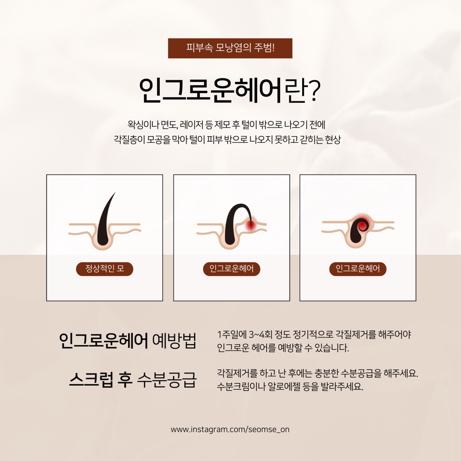 온 왁싱 이미지