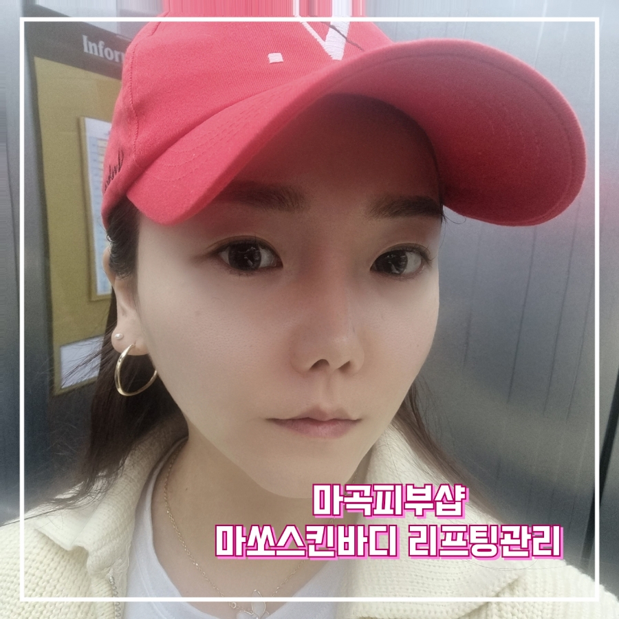 마쏘스킨바디 이미지