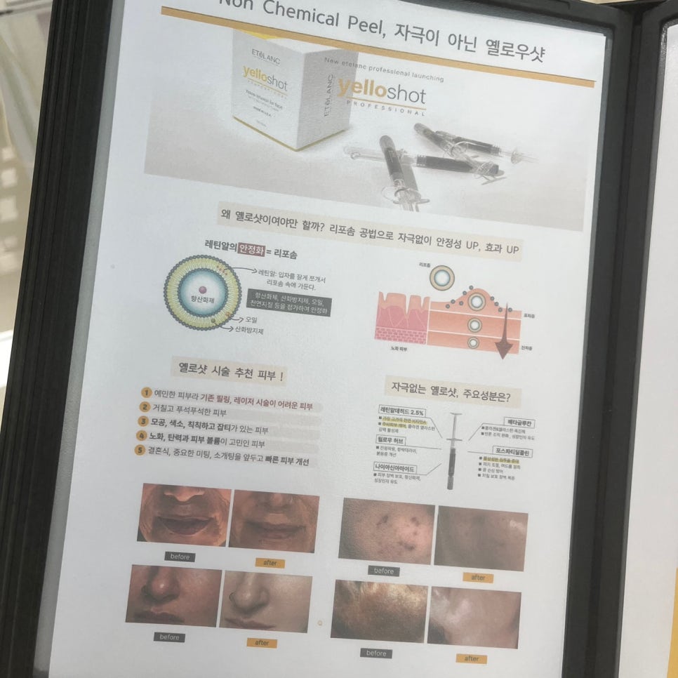 루시아 피부관리 이미지