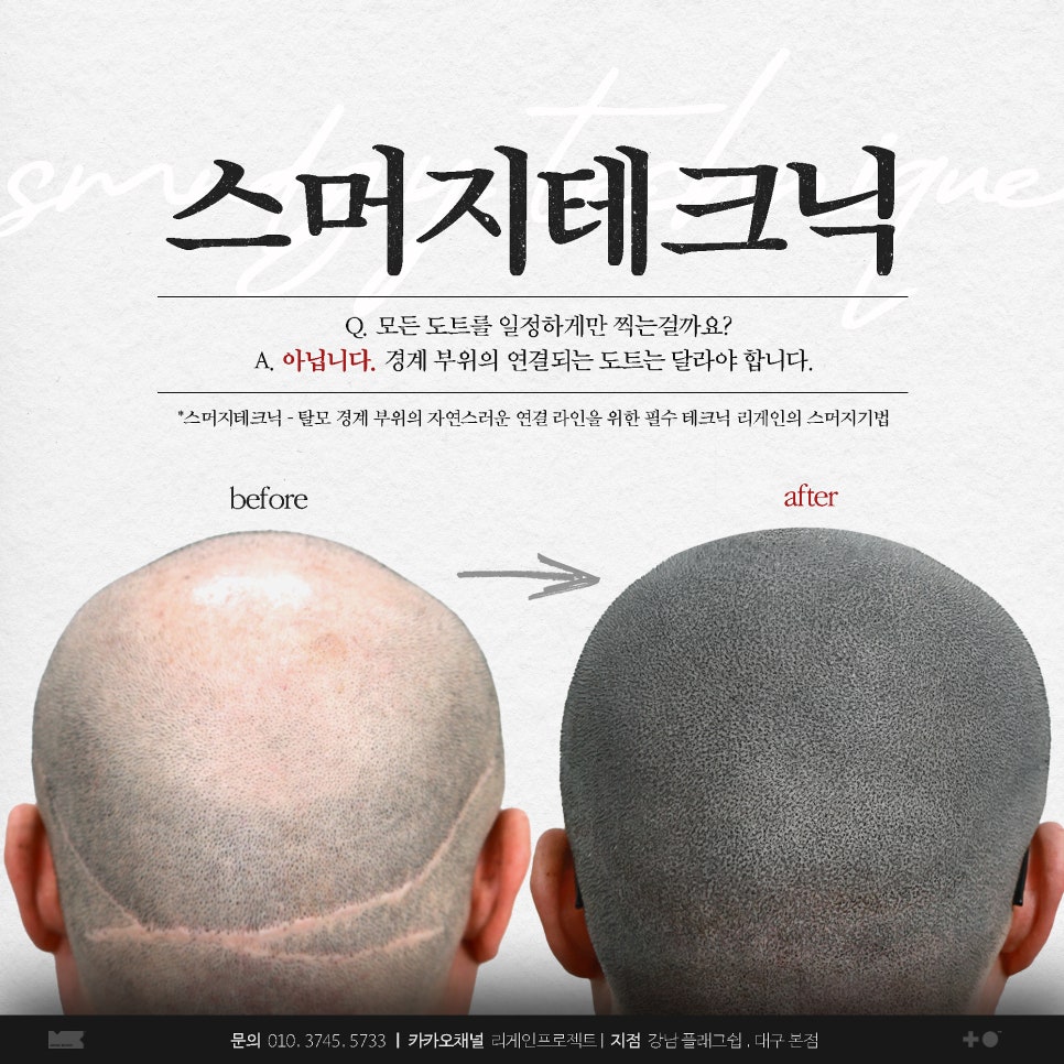 리게인프로젝트 이미지