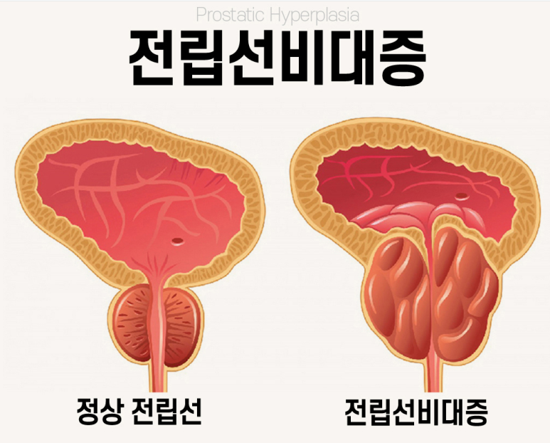 서울탑비뇨기과의원 이미지