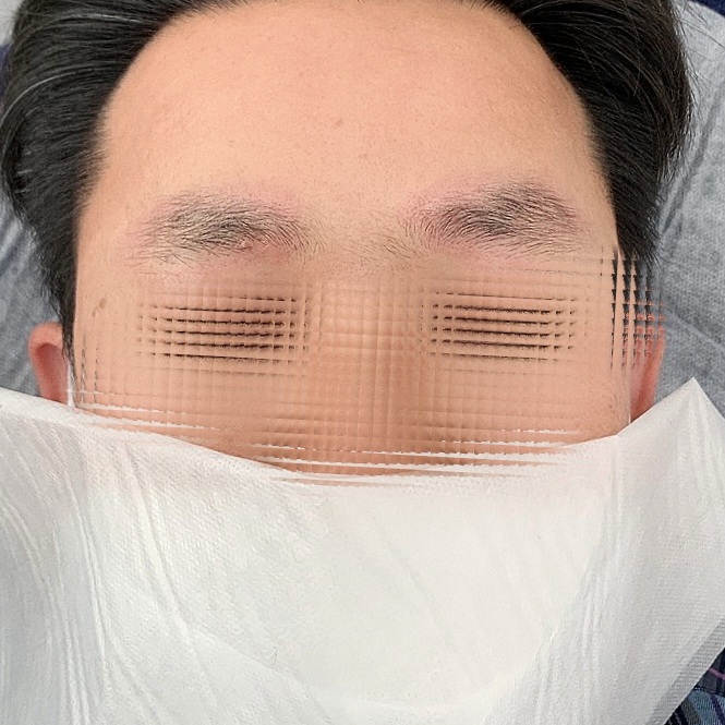 타미제뷰티 이미지