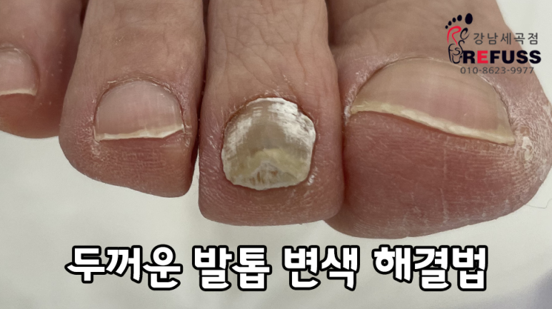 레푸스강남세곡점 이미지