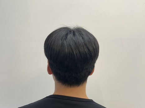 롣드 이미지