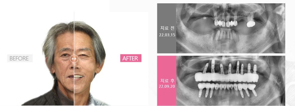 이튼치과의원 이미지