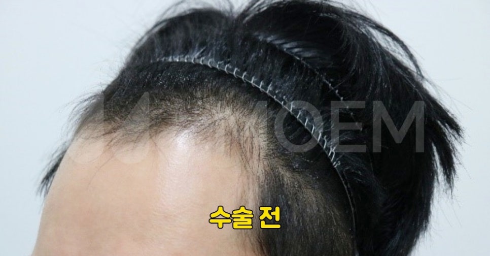 오던모발 이미지