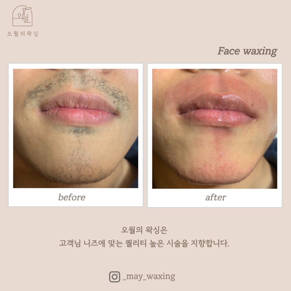오월의 왁싱 이미지