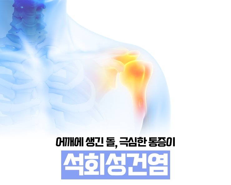 서울튼튼신경외과 이미지