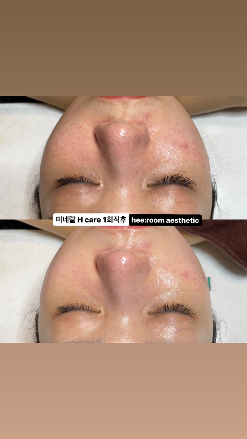 희룸에스테틱 이미지