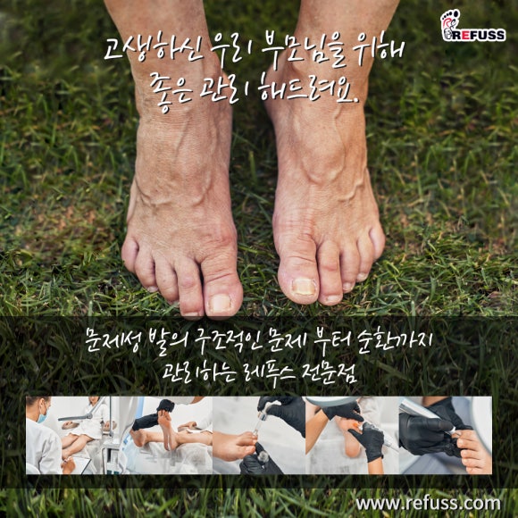 레푸스전주 이미지